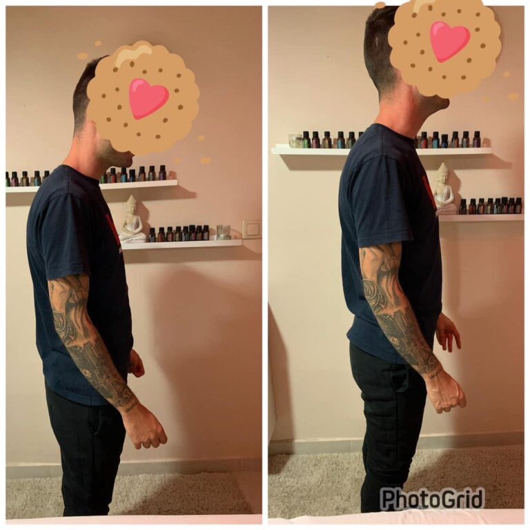 Előtte és utána 1