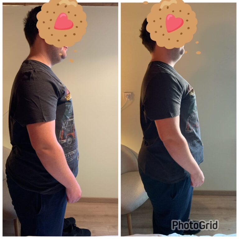 Előtte és utána 2