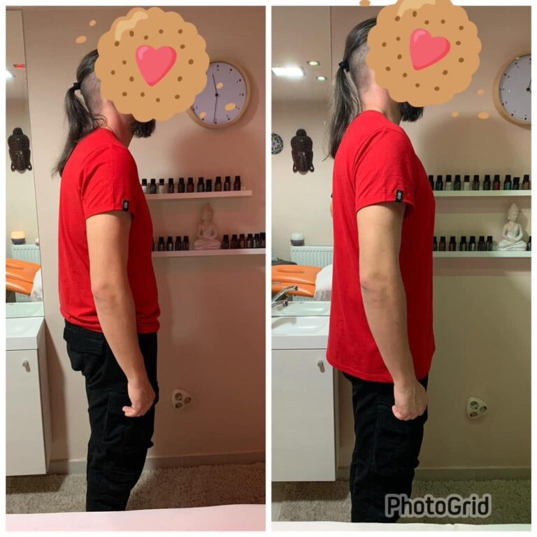 Előtte és utána 3